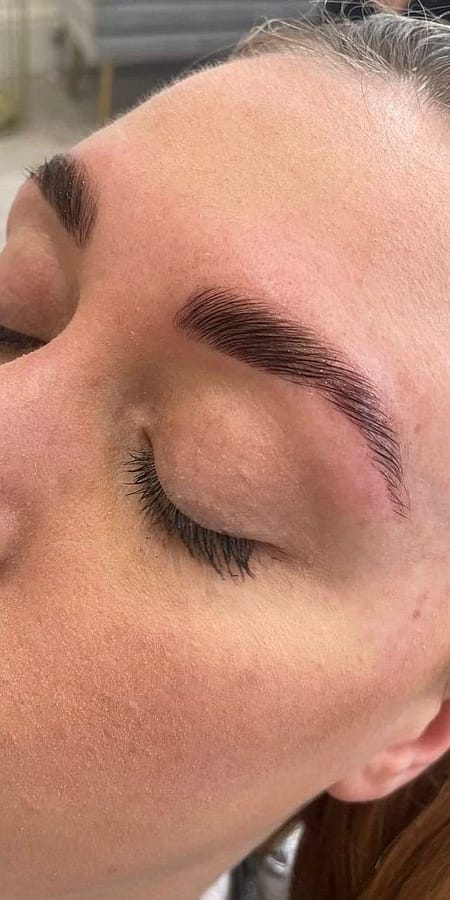 Before & After After