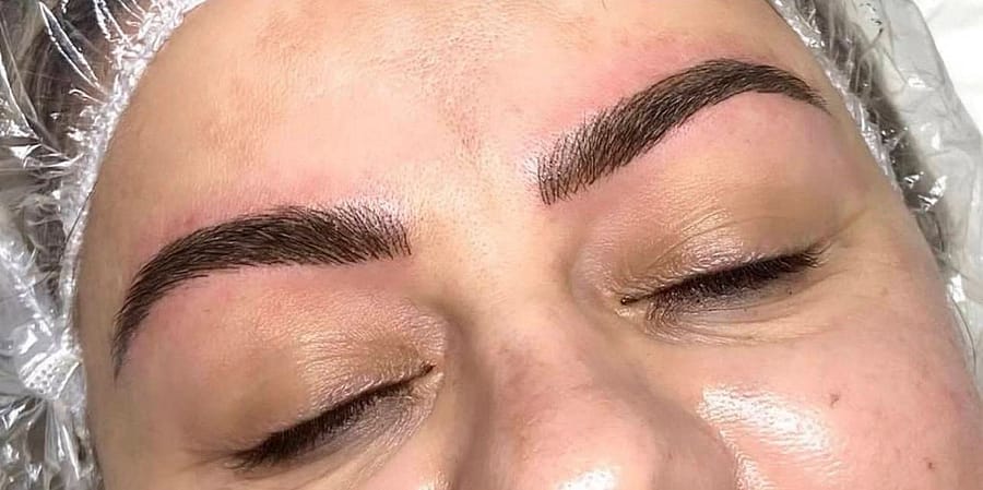 Before & After After