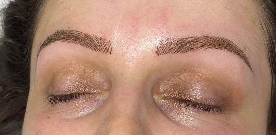 Before & After After