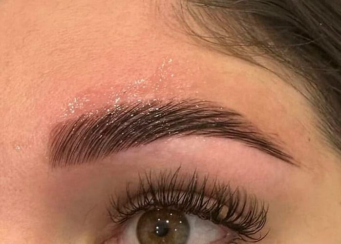 Before & After After