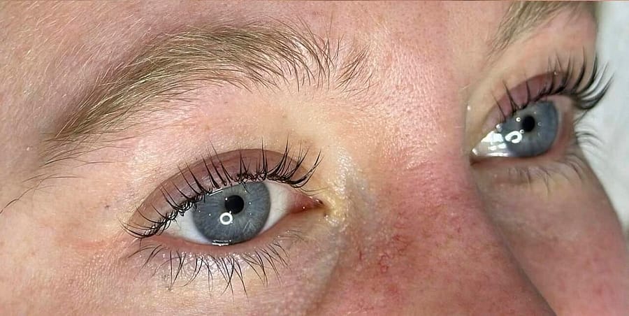 Before & After After